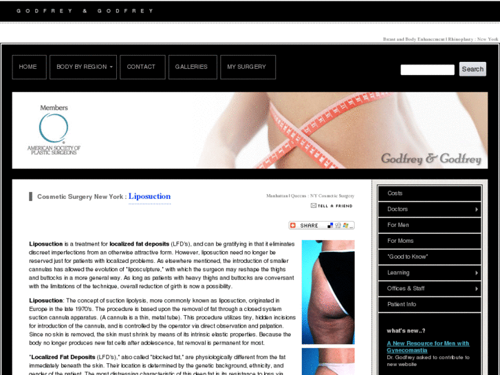 www.newyorkliposuction.com