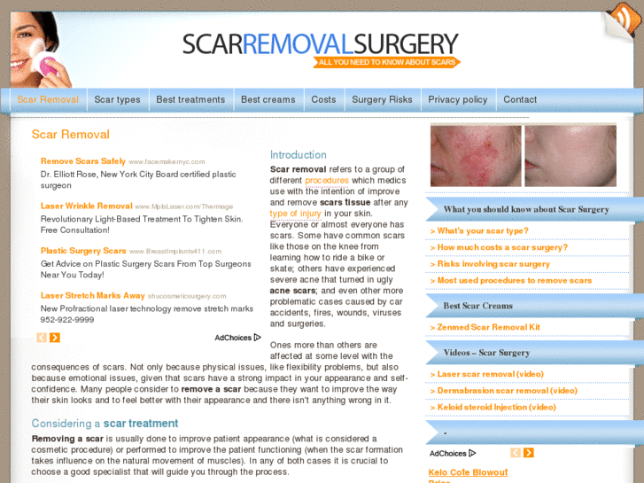 www.scarremovalsurgery.org