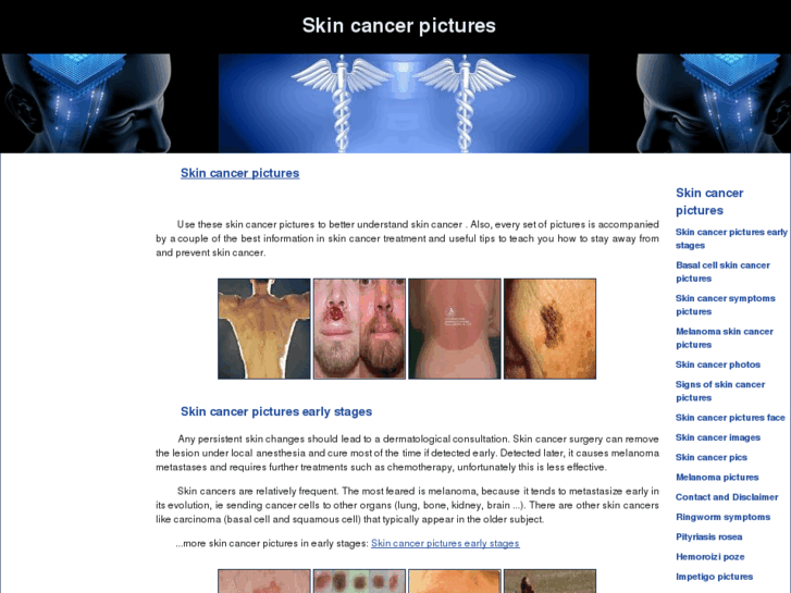 www.skincancer-pictures.com