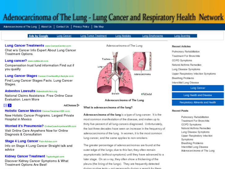 www.adenocarcinomaofthelung.net