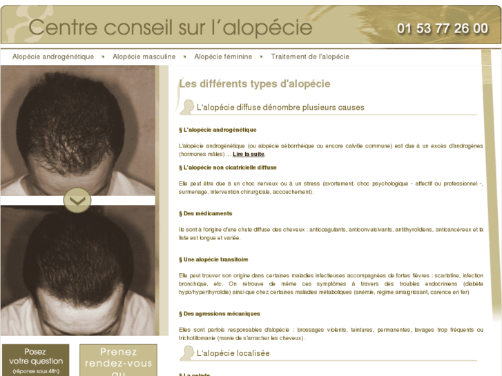 www.alopecie.biz
