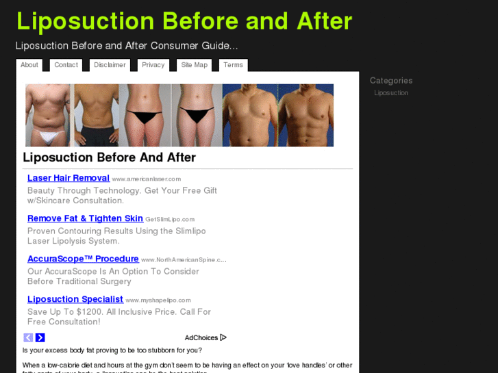 www.liposuctionbeforeafter.org