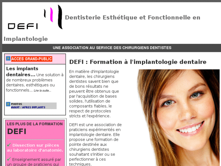 www.defi-implant.com