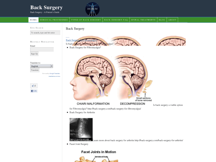 www.back-surgery.com