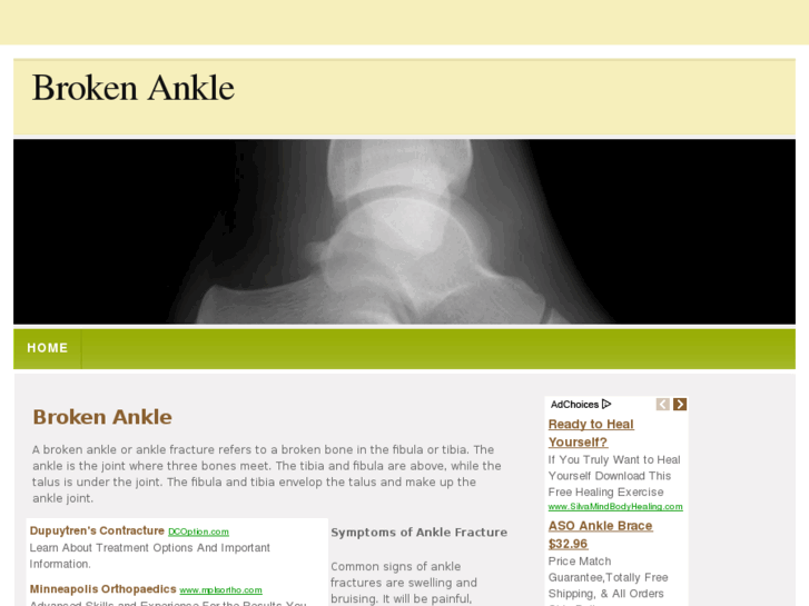 www.brokenankle.net