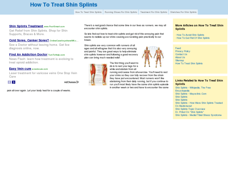 www.howtotreatshinsplints.com