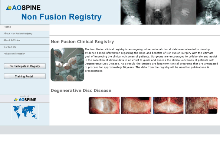 www.nonfusionregistry.com