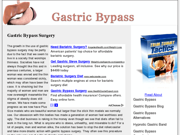 www.gastricbypass-advice.com