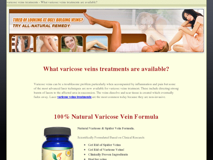 www.varicoseveinstreatments.info