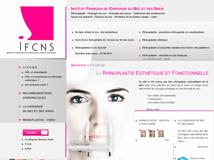 www.institut-rhinoplastie.com