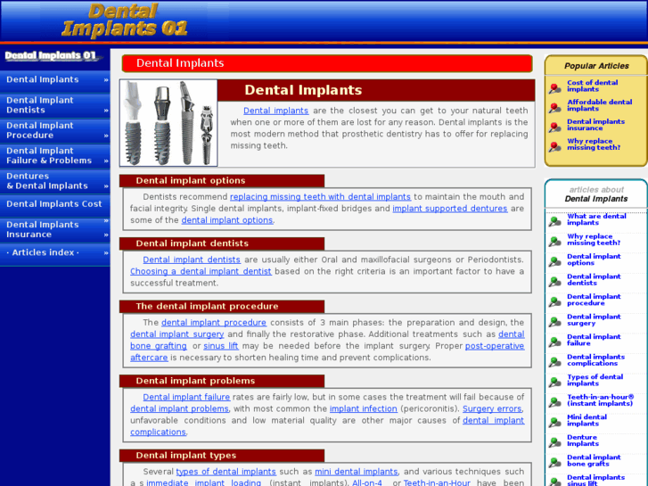 www.dental-implants-01.com