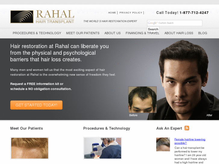 www.rahalhairtransplant.com