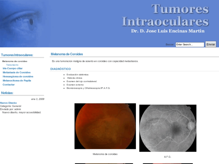 www.tumoresintraoculares.org