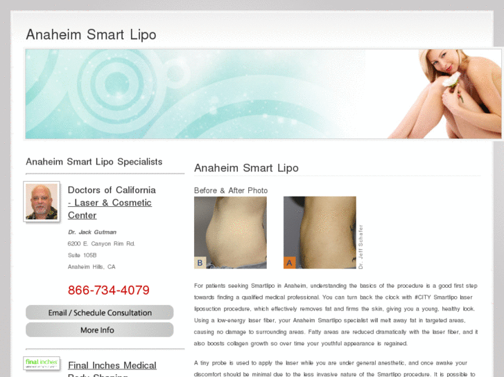 www.anaheimsmartlipo.com