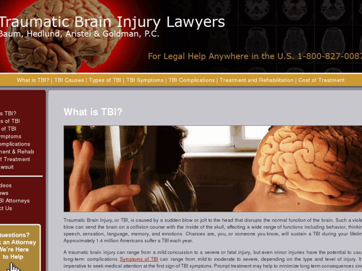 www.traumatic-brain-injury-lawfirm.com