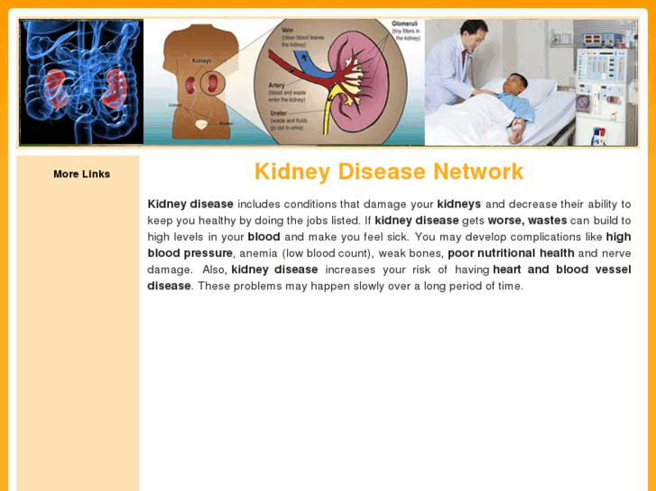 www.kidneydisease.net