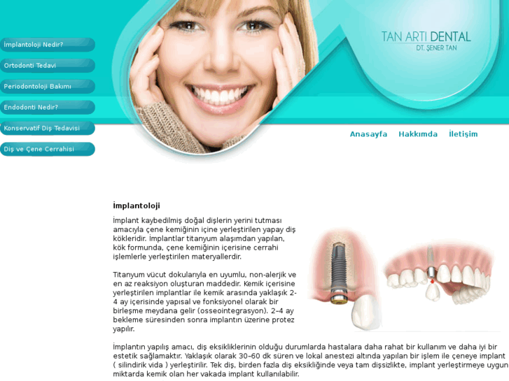 www.tanartidental.com