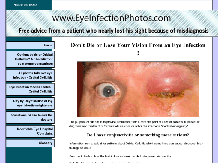 www.eyeinfectionphotos.com