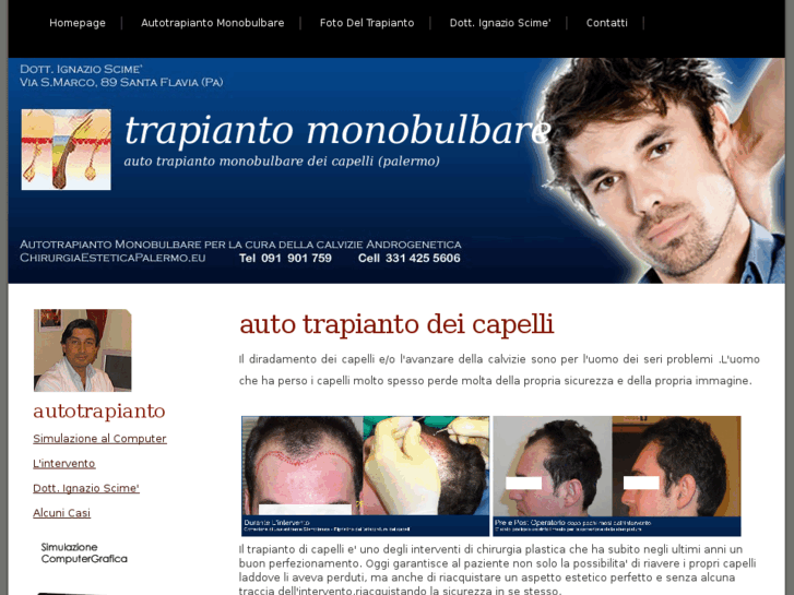 www.trapiantocapellipalermo.com