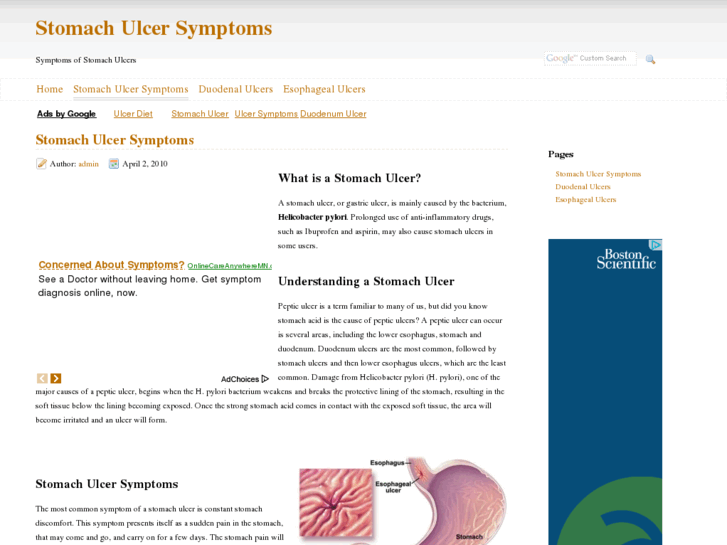 www.stomach-ulcer-symptoms.com