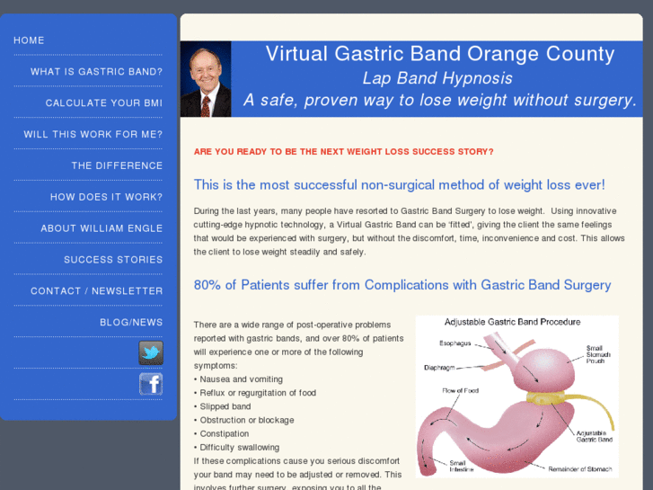 www.virtualgastricbandorangecounty.com