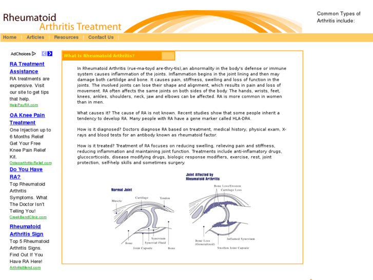 www.rheumatoid-arthritis-treatment.com