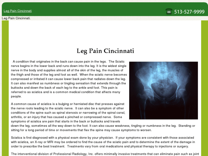 www.legpaincincinnati.com