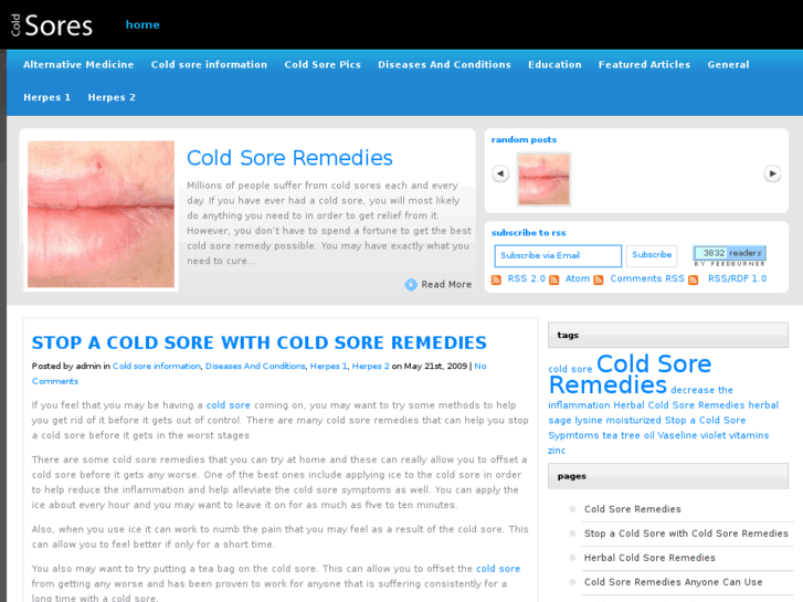 www.cold-sores.net