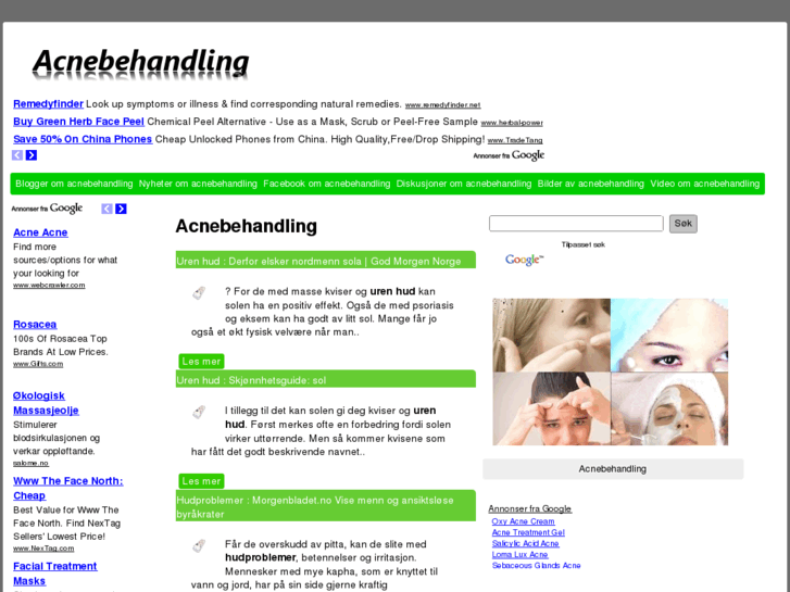 www.acnebehandling.info