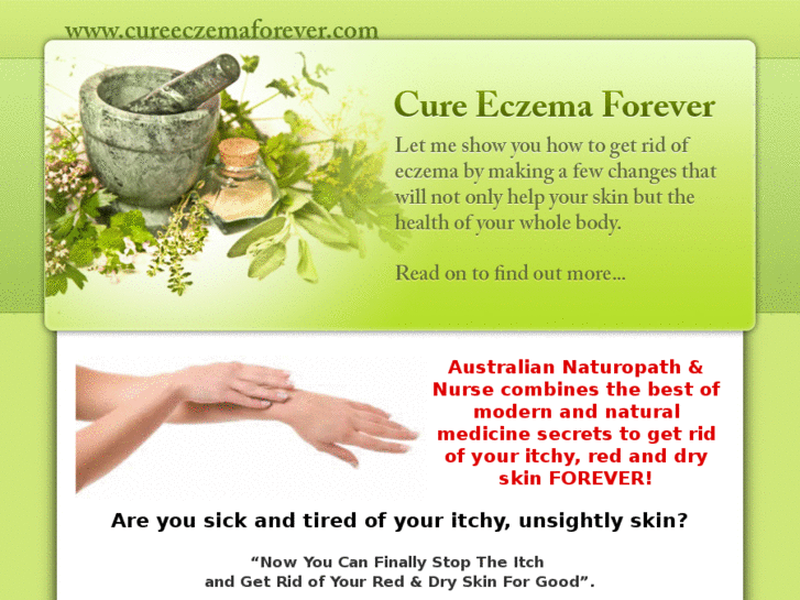 www.cureeczemaforever.com