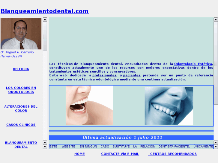 www.blanqueamientodental.com