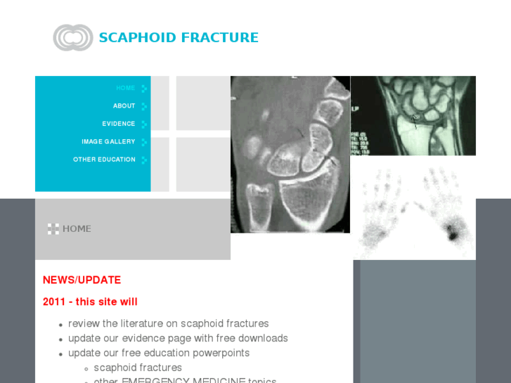 www.scaphoidfracture.com.au