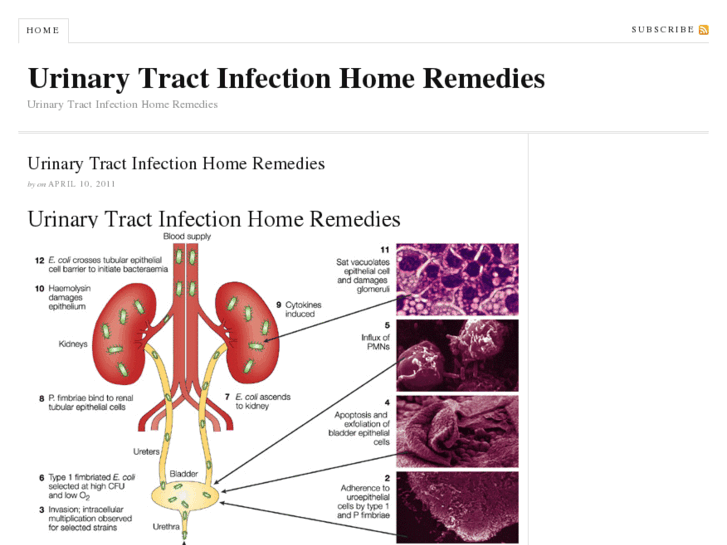 www.urinarytractinfectionhomeremediesx.com