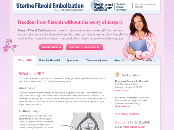 www.fibroid-doc.com