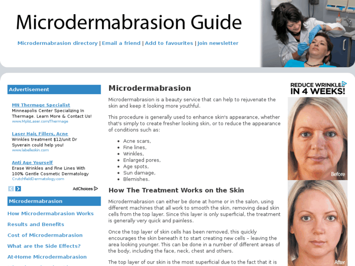 www.microdermabrasionguide.co.uk