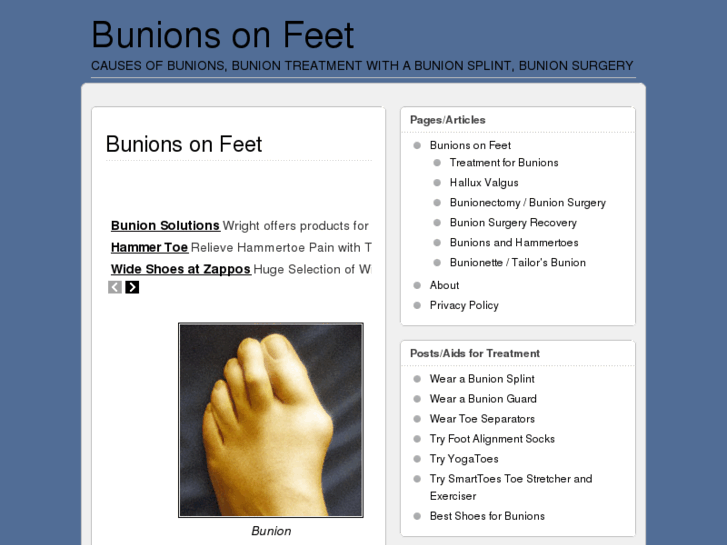 www.bunionsonfeet.org