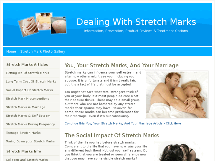 www.stretch-marks.me