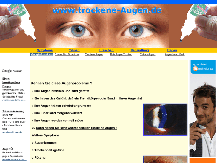 www.trockene-augen.de