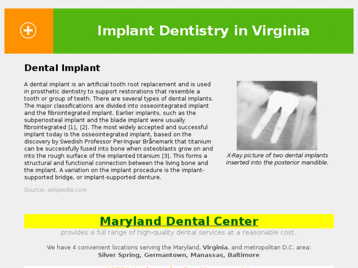 www.implantdentalvirginia.com