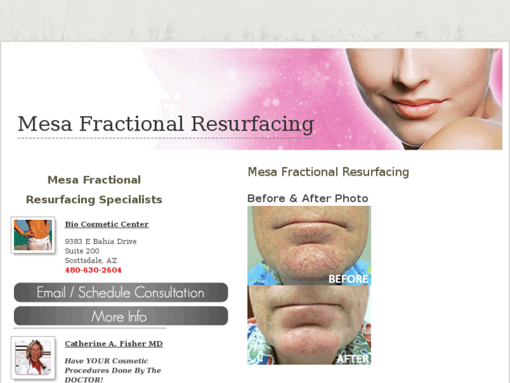 www.mesafractionalresurfacing.com