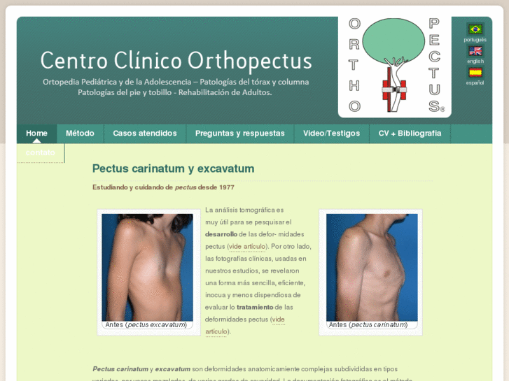 www.orthopectus.es