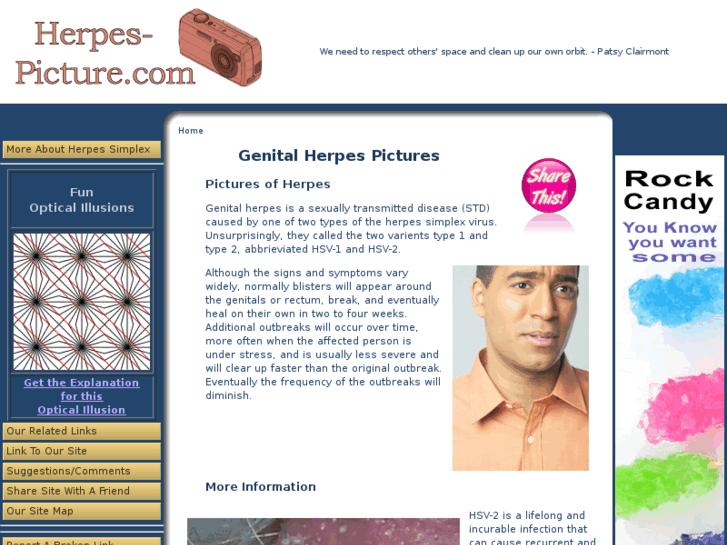 www.herpes-picture.com