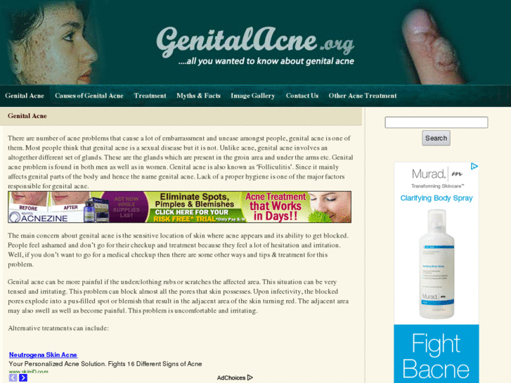 www.genitalacne.org