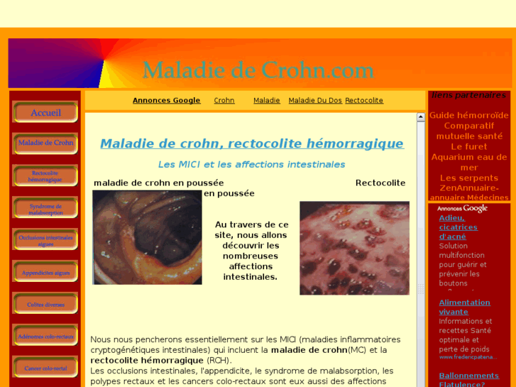 www.maladie-de-crohn.com