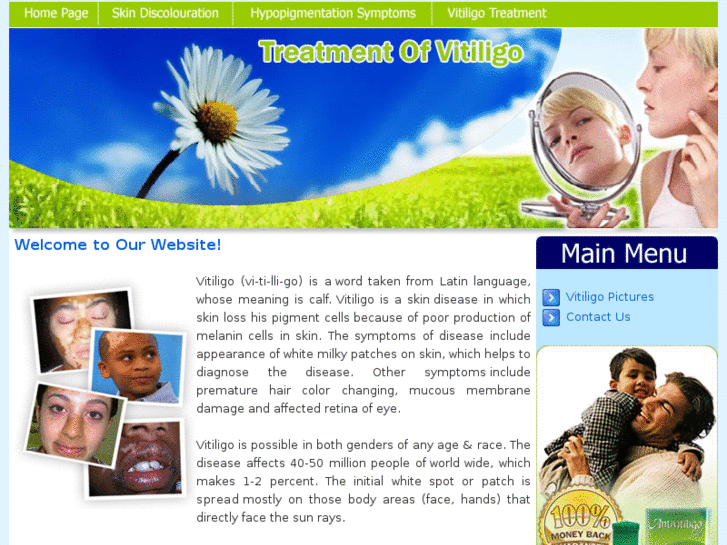 www.treatmentvitiligo.com