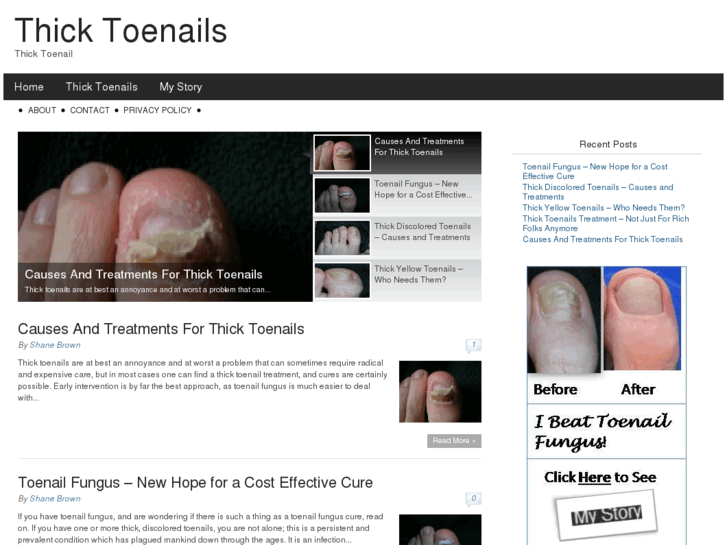 www.thicktoenails.org