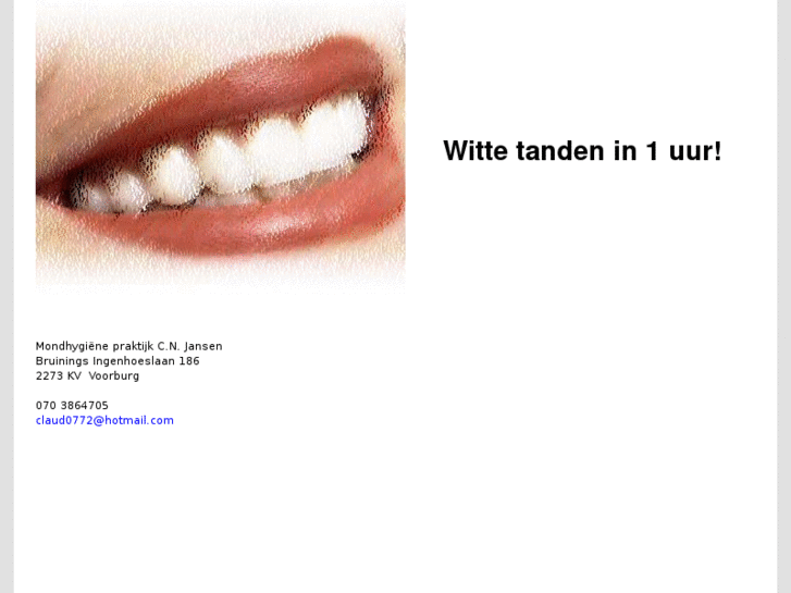 www.wittetanden.net