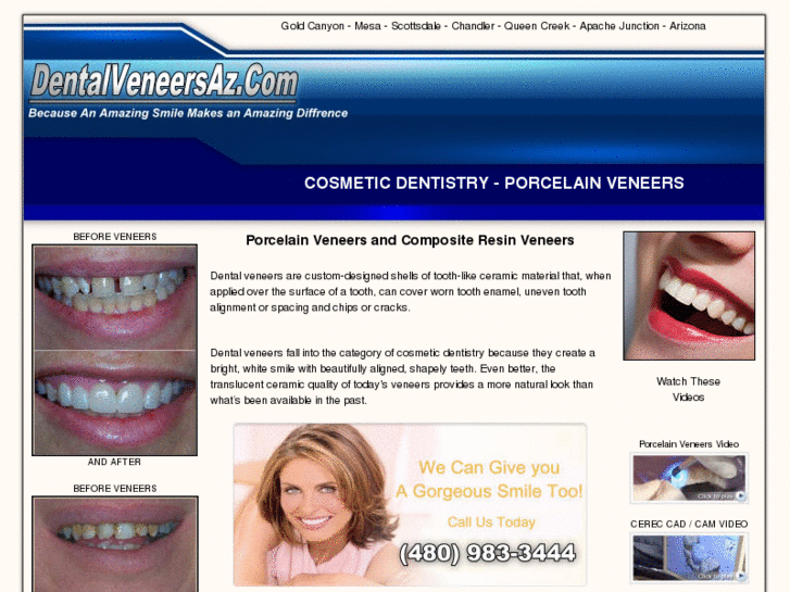 www.dentalveneersaz.com