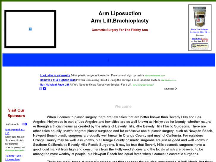 www.arm-liposuction.com