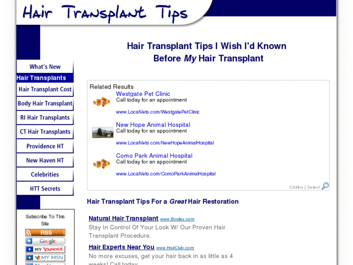 www.hair-transplant-tips.com